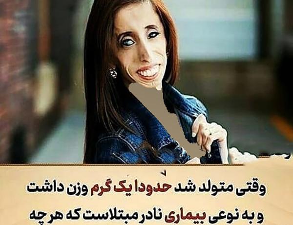 عکس امریکایی زشت