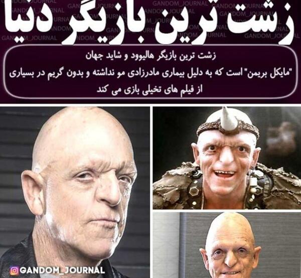عکس آدم زشت ترین جهان