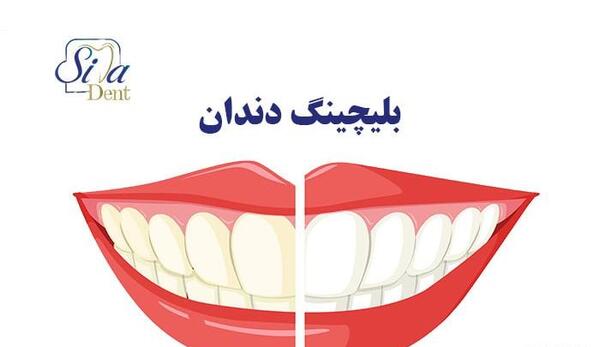 عکس دندان سفید و مرتب