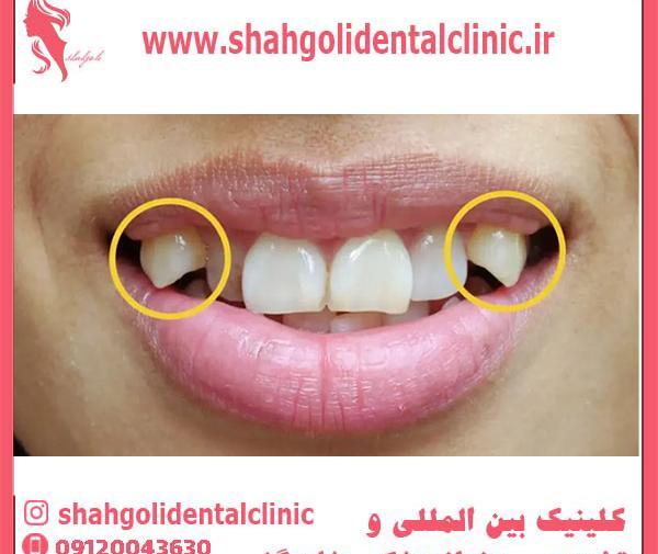 عکس دندان سفید و مرتب