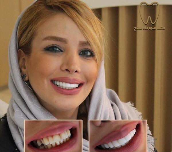 عکس دندان سفید و مرتب