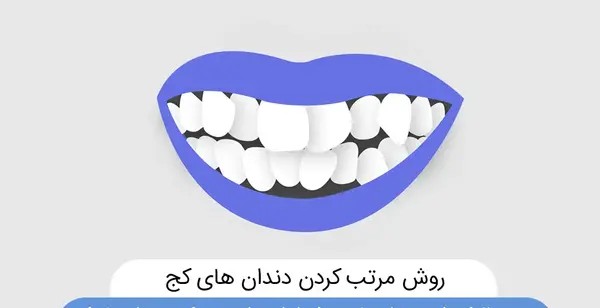 عکس دندان سفید و مرتب