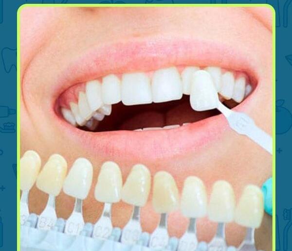 عکس دندان های سفید