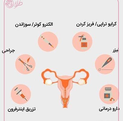 عکس زگیل تناسلی سفید رنگ