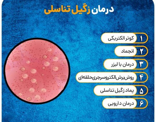 عکس زگیل تناسلی سفید رنگ