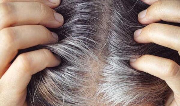 عکس موهای سفید طبیعی
