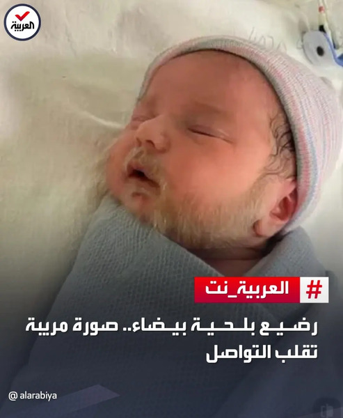 عکس نوزاد سفید