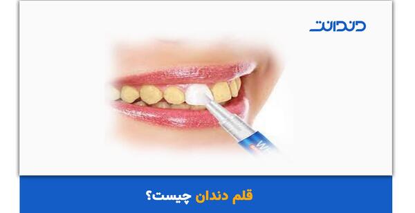 عکس قلم سفید کننده دندان