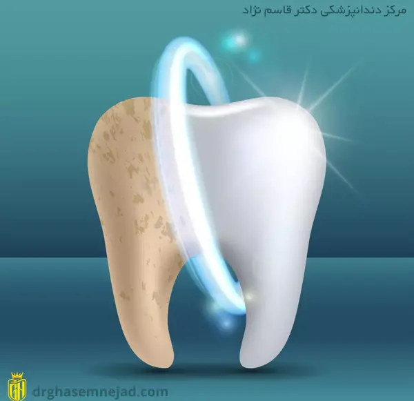 عکس قلم سفید کننده دندان