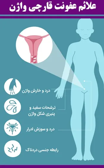 عکس ترشح سفید شیری