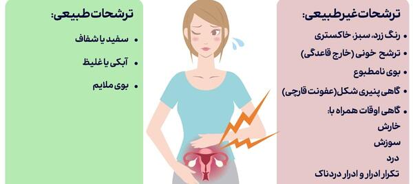 عکس ترشح سفید شیری