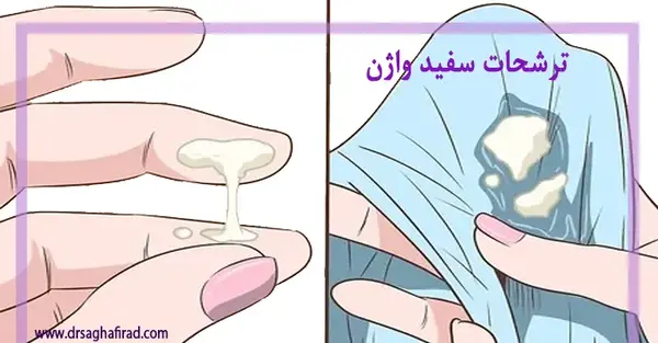 عکس ترشحات سفید شیری