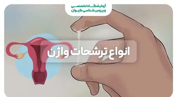 عکس ترشحات سفید شیری