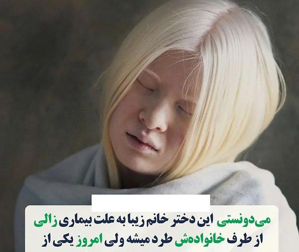 عکس زشت ترین چیز دنیا