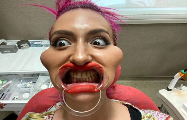 عکس زن زشت زشت