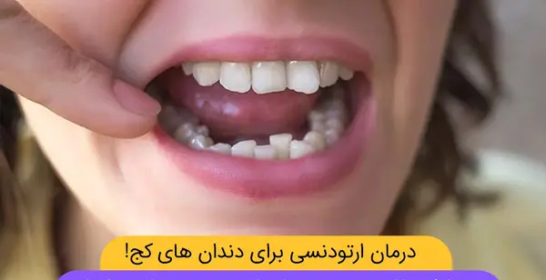 عکس مرد زشت بی دندون