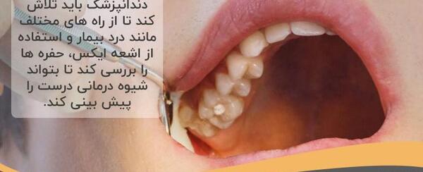 عکس مرد زشت بی دندون