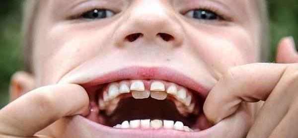 عکس مرد زشت بی دندون