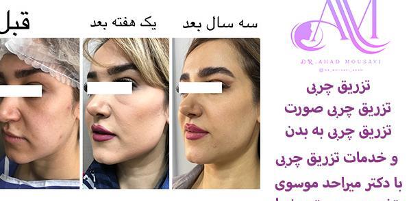 عکس ادم لاغر زشت