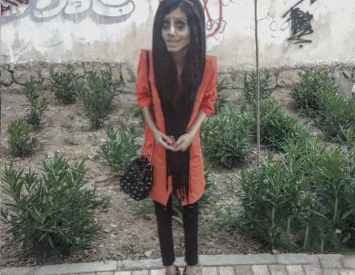 عکس ادم لاغر زشت