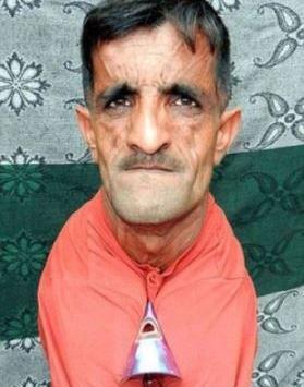 عکس ادم لاغر زشت
