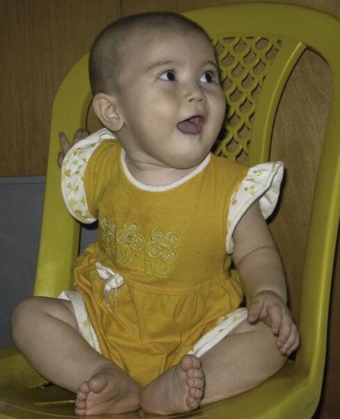 عکس نی نی خیلی زشت