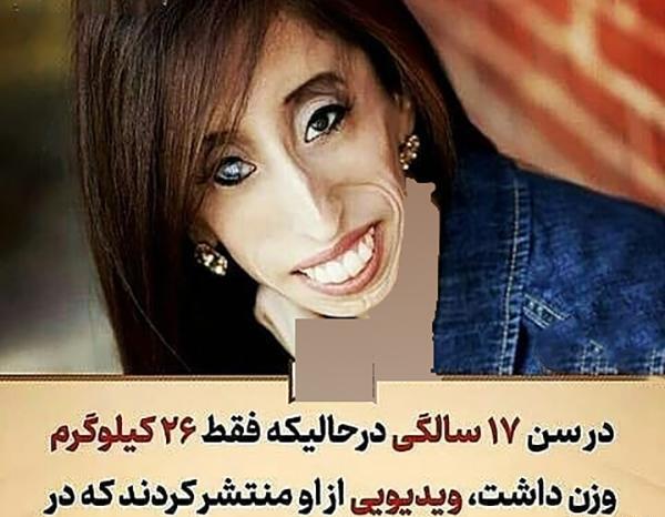 عکس زشت ترین آدم های جهان