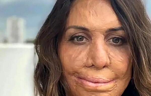 عکس همسر زشت