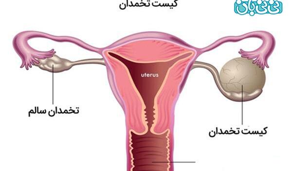 عکس خواص عرق رازیانه