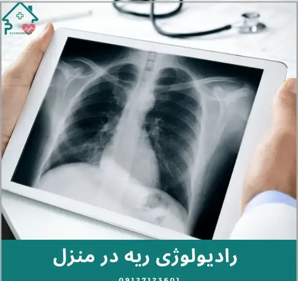 عکس رادیولوژی ریه کرونایی