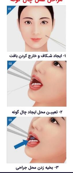 نيم رخ عکس فیک دخترونه چال گونه