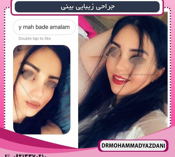 عکس قبل از عمل زلیخا در سریال روزگاری در چوکوروا