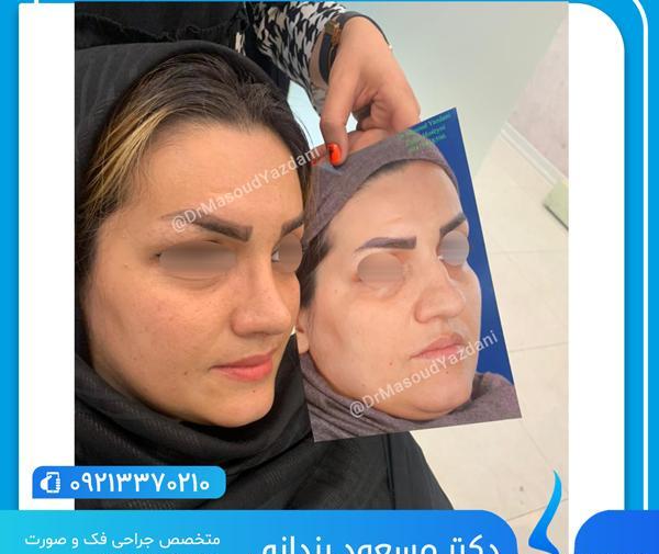 عکس قبل از عمل زلیخا در سریال روزگاری در چوکوروا