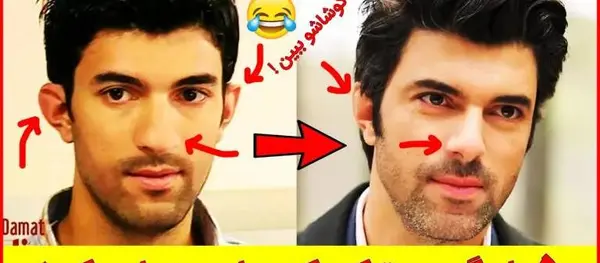 عکس های قبل از عمل زلیخا در چوکوروا