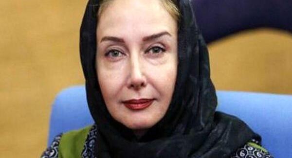 عکس زلیخا قبل از عمل بینی