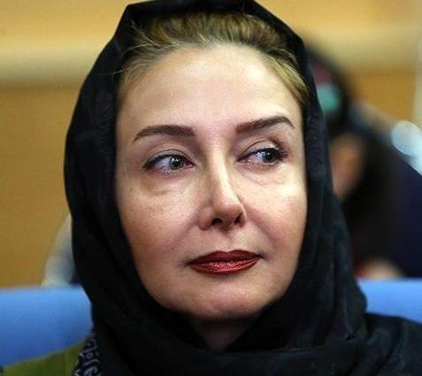 عکس زلیخا قبل از عمل بینی