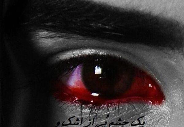 عکس چشم اشکی طبیعی