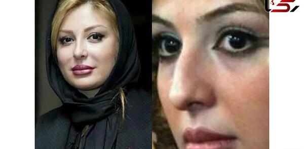 عکس های خنده دار عمل زیبایی