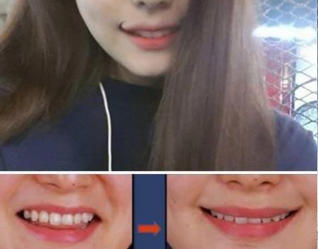 عکس های خنده دار عمل زیبایی