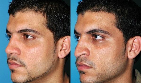 عکس های خنده دار عمل زیبایی