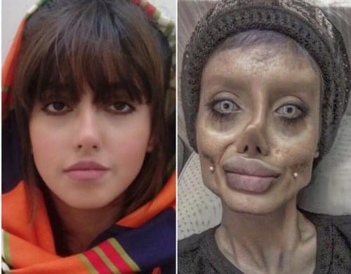 عکس های خنده دار عمل زیبایی