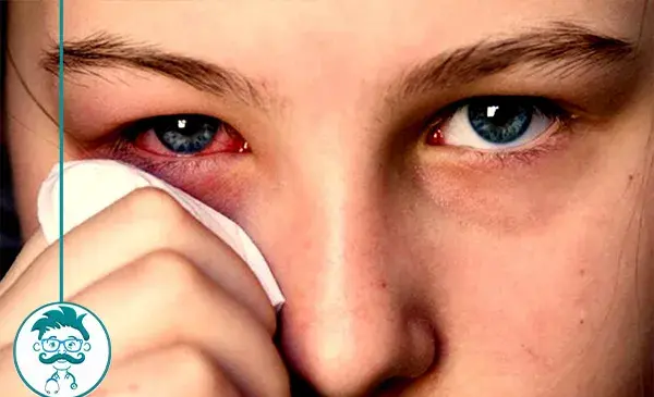 عکس چشم قرمز شده دختر