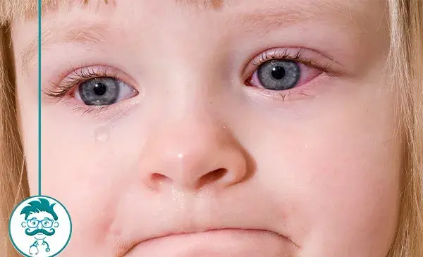 عکس چشم قرمز شده دختر