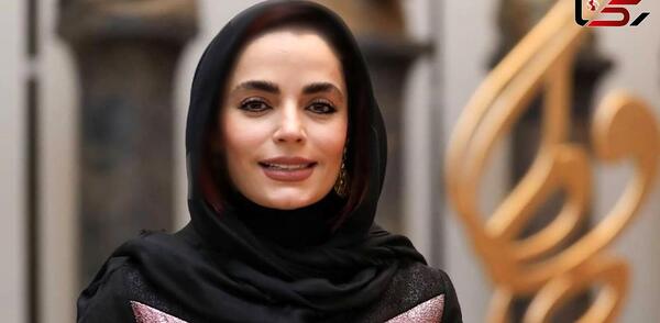 عکس سپیده خداوردی قبل از عمل زیبایی