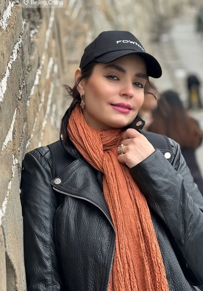 عکس سپیده خداوردی قبل از عمل زیبایی