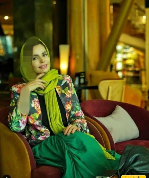 عکس سپیده خداوردی قبل از عمل زیبایی