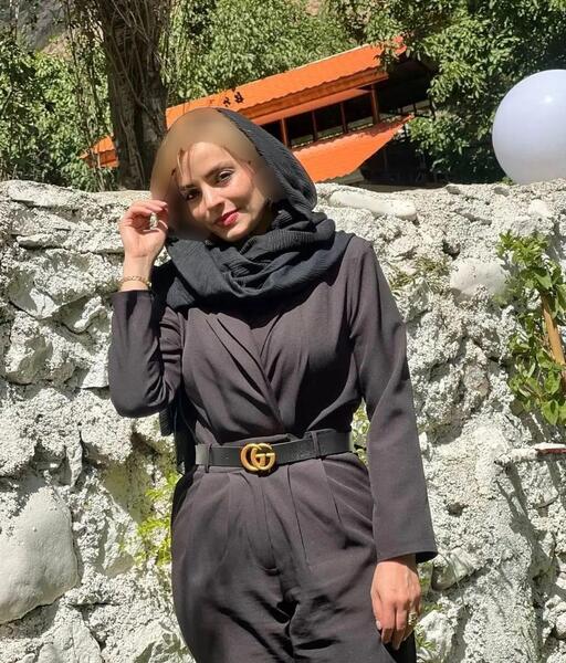 عکس سپیده خداوردی قبل از عمل زیبایی