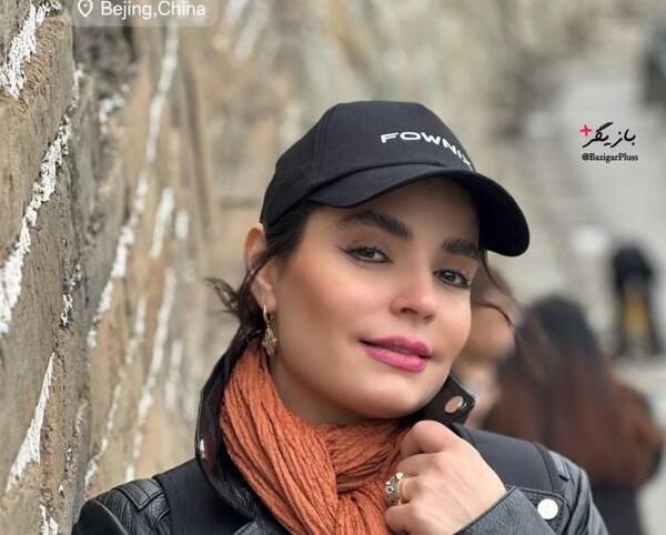 عکس سپیده خداوردی قبل از عمل زیبایی