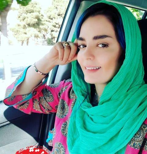 عکس سپیده خداوردی قبل از عمل زیبایی
