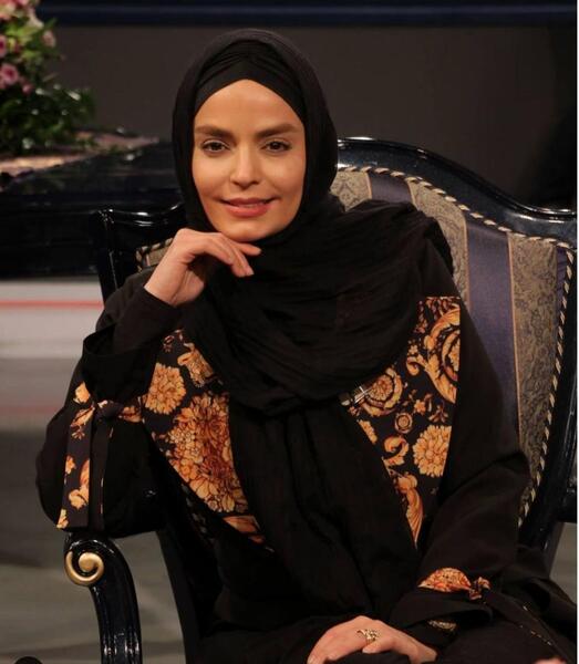 عکس سپیده خداوردی قبل از عمل زیبایی